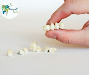 Zirconia crown