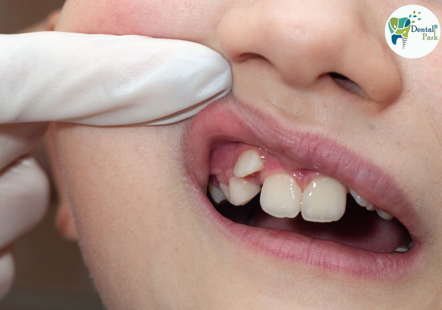 orthodontist doctor | dentist near me | dentist in ghaziabad | best dentist | dentist | braces | aligner