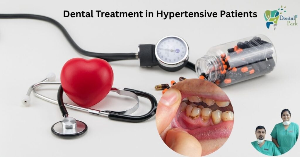 Dental Treatment in Hypertensive Patients